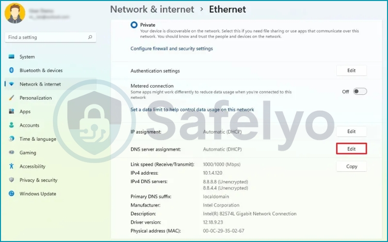 Edit the DNS server assignment Edit the DNS server assignment