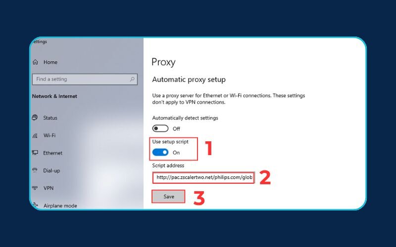 Automatic proxy setup script